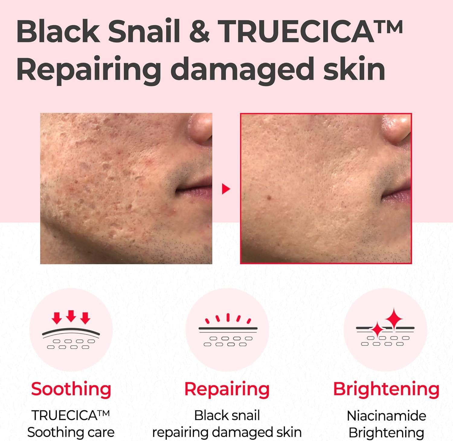 Some By MI SNAIL TRUECICA MIRACLE REPAIR TONER 150ml