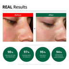 Dr.G Red Blemish Clear Soothing Cream 70ml