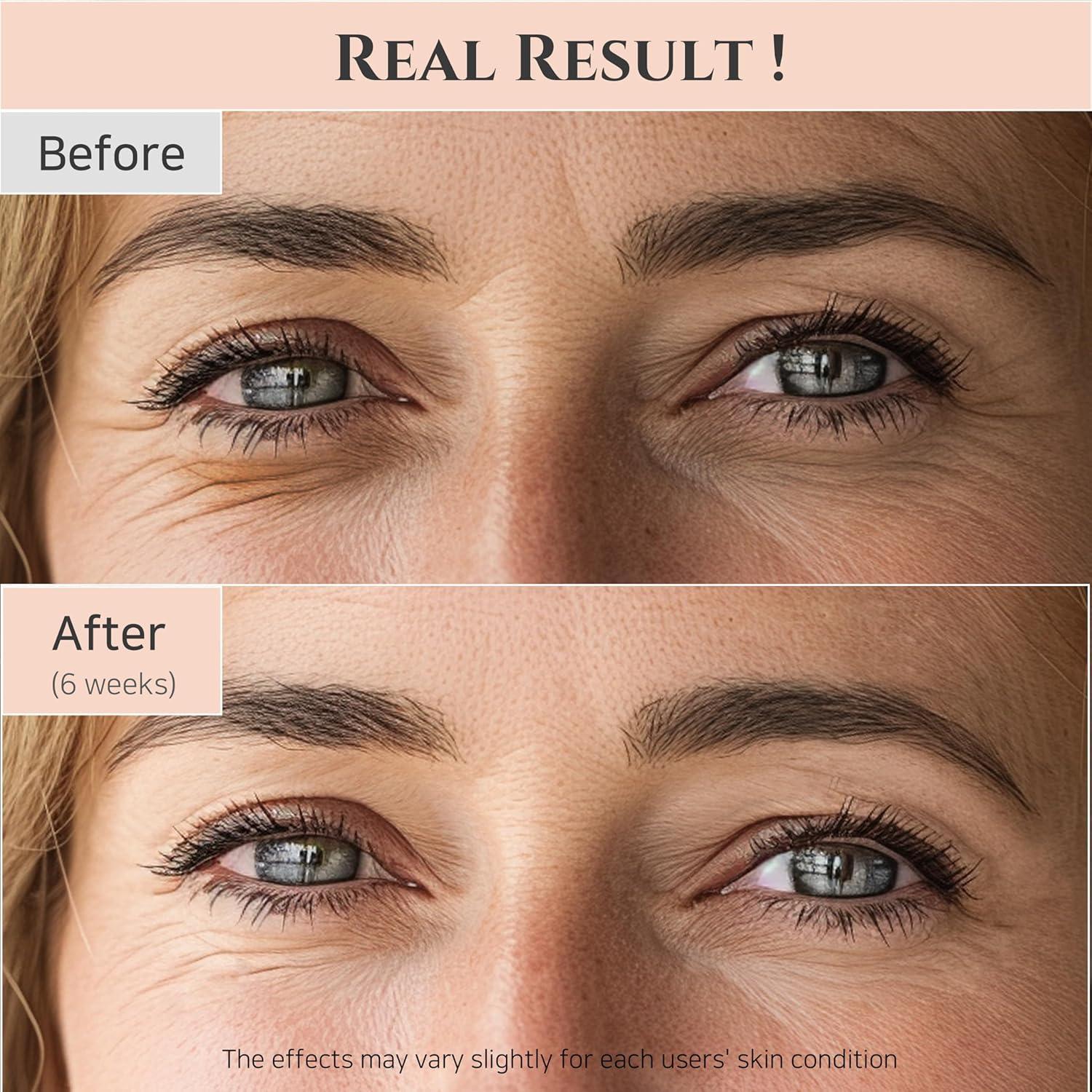 Beauty Of Joseon Revive Eye Serum : Ginseng + Retinal 30ml